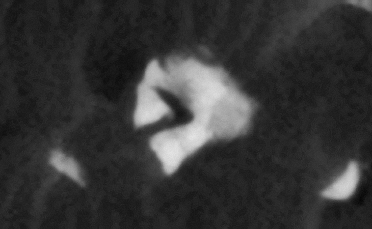 Click for original image at 1:1 scale