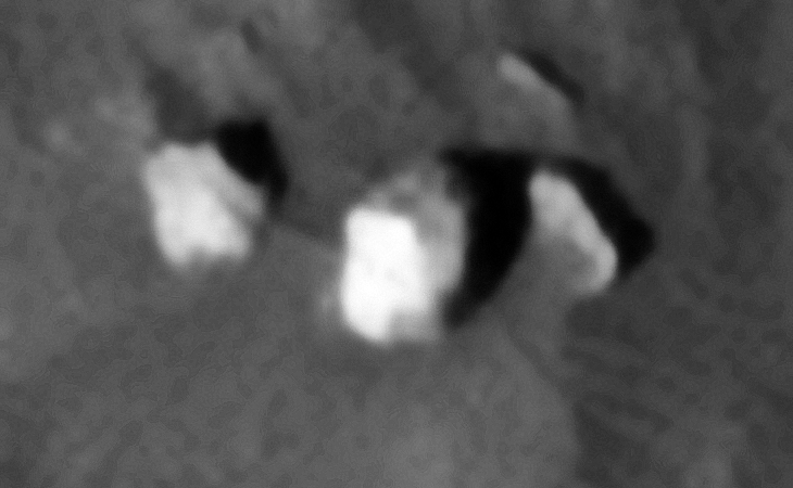 Partially buried mangled machine parts or pieces of a structure or statue, the object to the left has a perfectly circular side and the object in the middle has a flat side with right-angled features