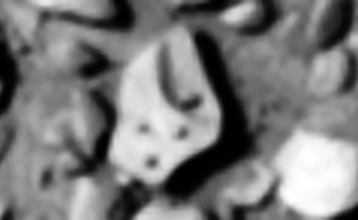 Click for original image at 1:1 scale